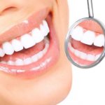 Lente de contato dental