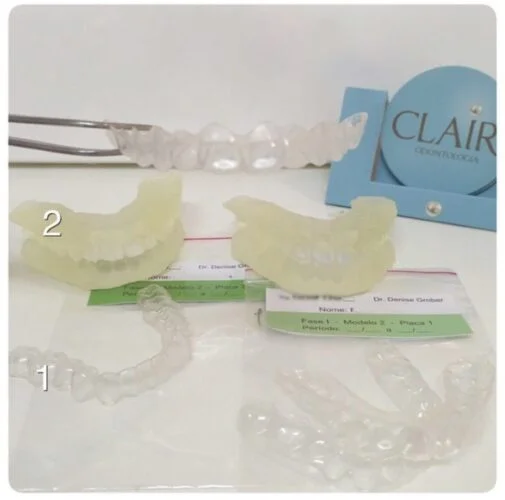 Transformação do meu sorriso - Aparelho dentário invisível Transformação do meu sorriso - Aparelho dentário invisível