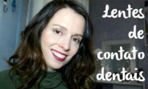 Transformação: Minhas lentes de contato dental