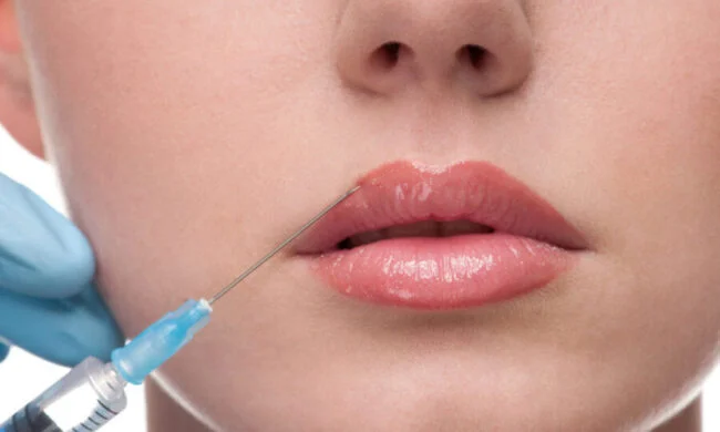 harmonização facial