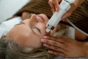 O melhor procedimento a laser para tratar manchas