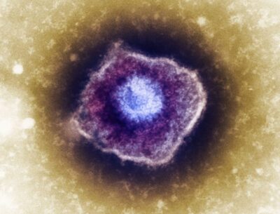Especialistas explicam a herpes zoster