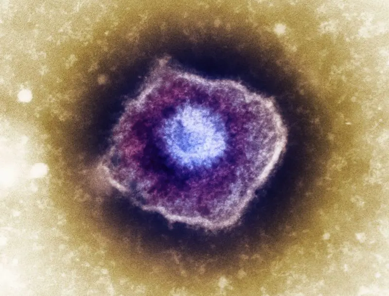 explain about herpes zoster